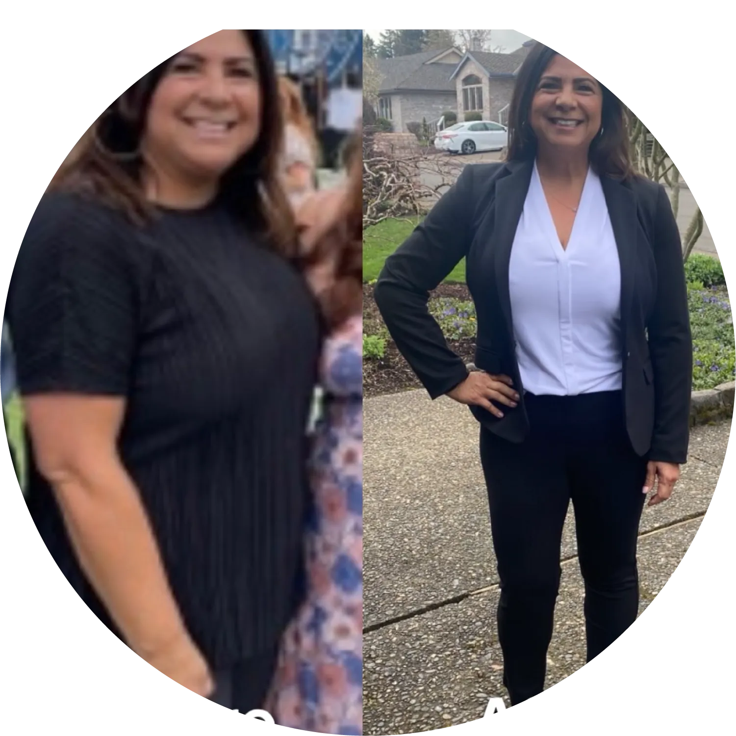 Before-After-17 -1- Woman before and after weight loss, showing confident transformation.